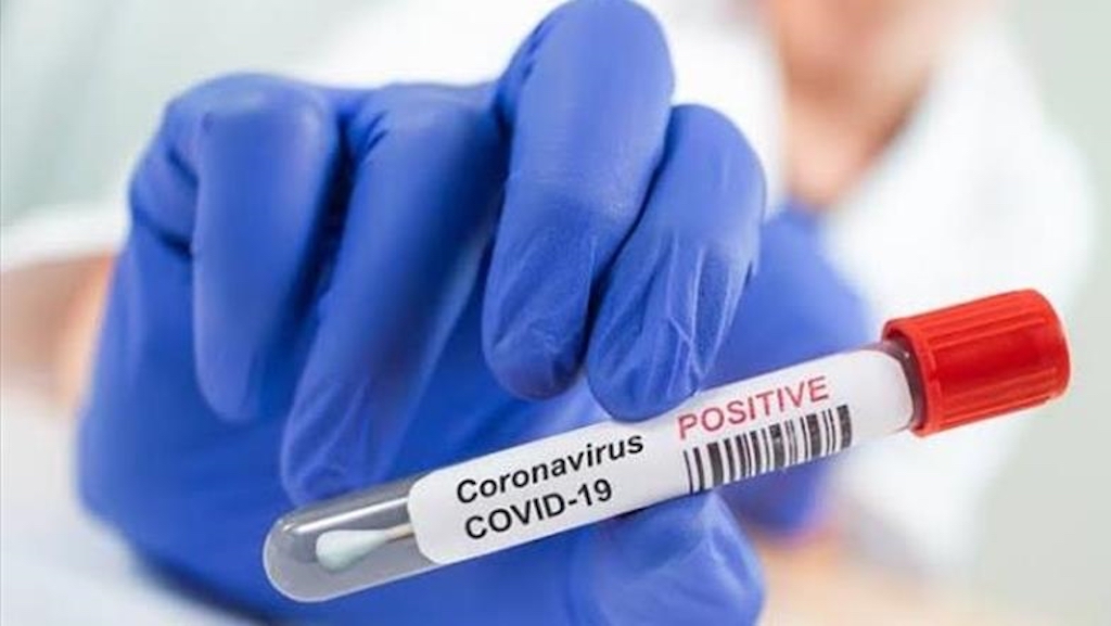 COVID-19: Nigeria files 31 fresh infections in two days