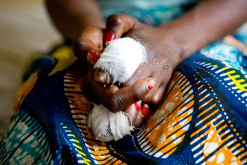 Higher discovering out boosts leprosy response in the Democratic Republic of the Congo