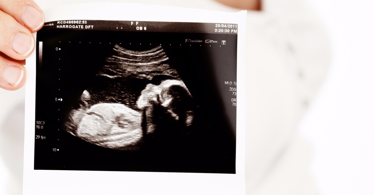 ‘Infants within the Womb’: NBC’s In the present day Surprises Professional-Lifers with 3D Ultrasound Story