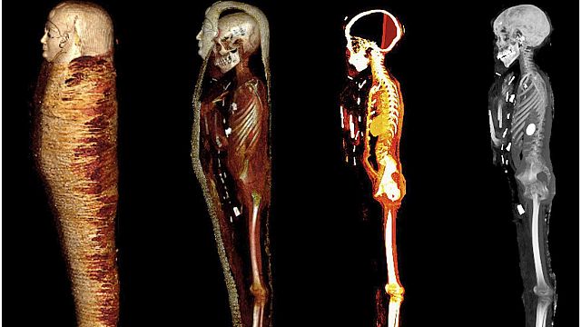 Secrets and techniques of two,300-year-old golden boy mummy revealed by CT scans