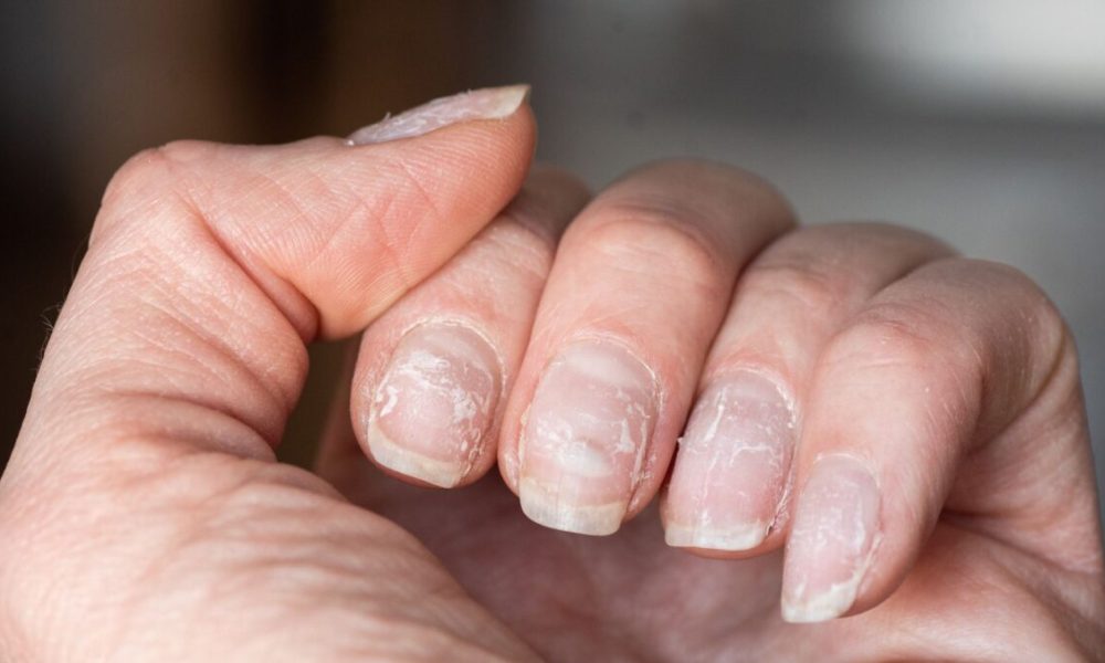 Facet Results Of Nail Polish Ladies Should Know – Way of life Nigeria