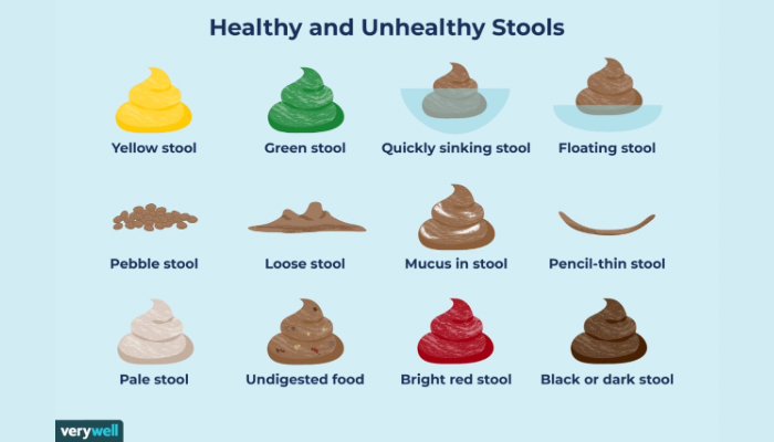 What the color of your poop says about your well being
