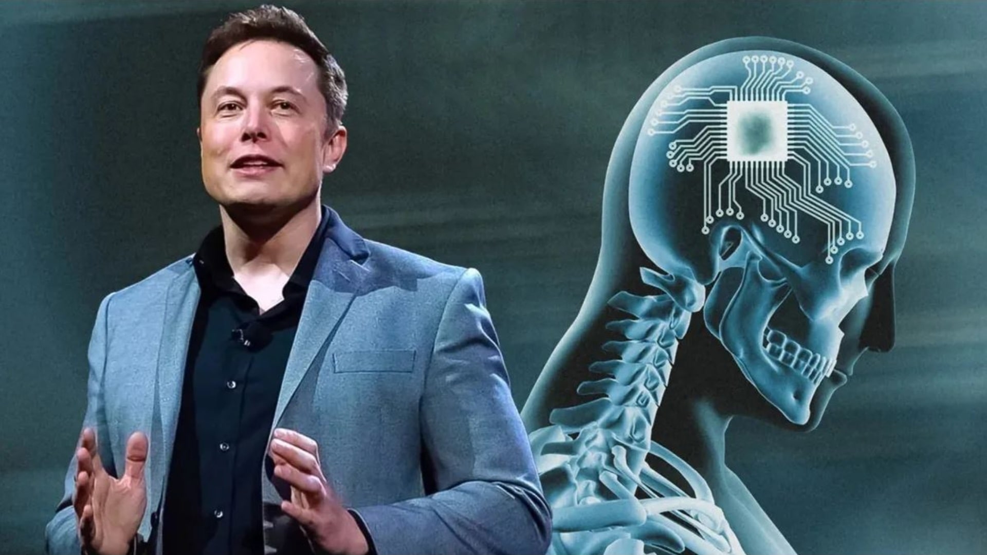 Elon Musk’s Startup in Search of Volunteers Whose Brains Will Be Minimize Open for Wire Implant