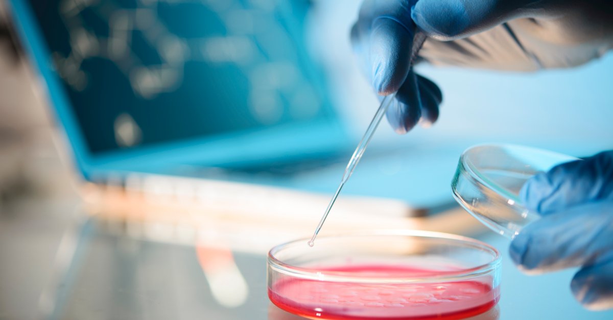 First U.S. Case of Sexually Transmitted Fungal An infection Present in New York Metropolis