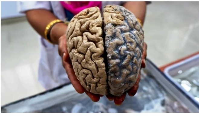 You Are Slowly Killing Your Mind If You Preserve Doing These Three (3) Issues, Don’t Ignore