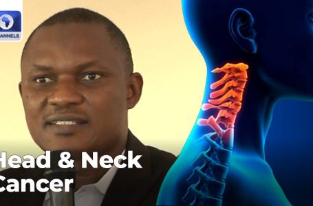 Head & Neck Most cancers: Medical Specialists Increase Concern Over Prevalence Of Illness In Nigeria