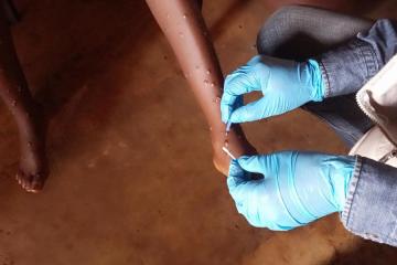 Scaling up response to curb rising mpox outbreak in African area