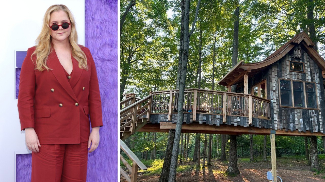 Amy Schumer Has Luxurious $300,000 Customized Treehouse Inbuilt Her Yard—See Inside Her ‘Dream’ Area