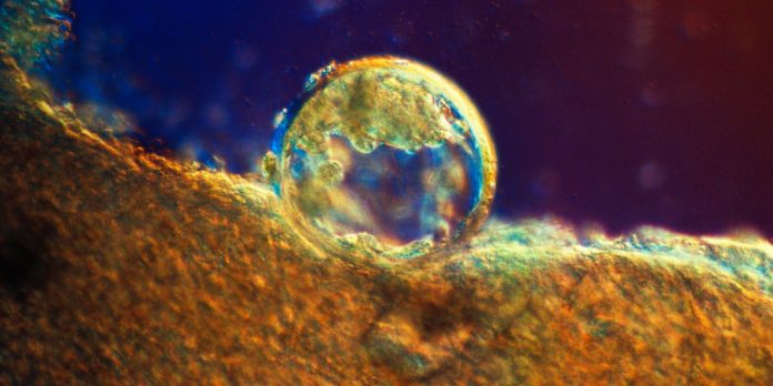 Donating embryos for analysis is surprisingly advanced