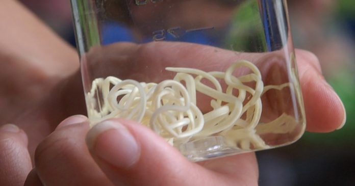 Jimmy Carter needed to see Guinea worm illness eradicated. He got here very shut.