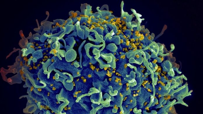 US says life-saving HIV remedy can proceed throughout assist pause