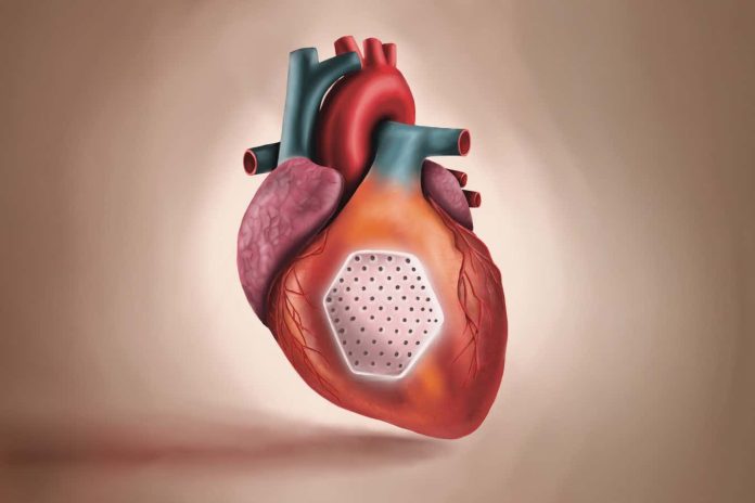 Muscle patch constituted of stem cells may deal with coronary heart failure