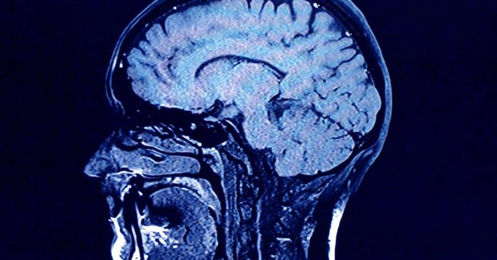 Examine finds rising ranges of microplastics in human brains