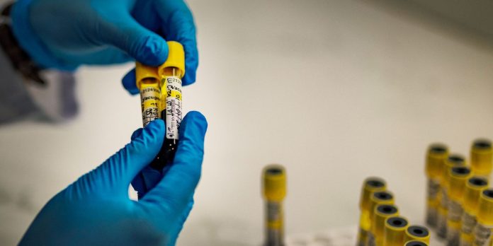 HIV may infect 1,400 infants day by day due to US help disruptions