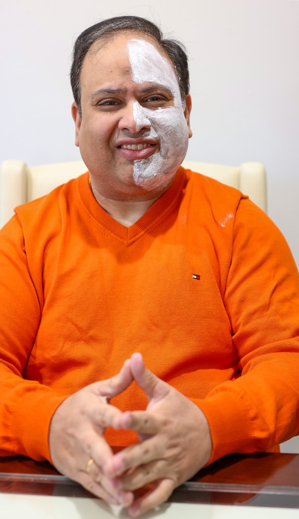 Inside a Lengthy Island man’s journey from struggles with cerebral palsy to launching a skincare line with distinctive household cures