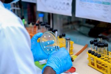 Scaling up response to anthrax outbreak within the Democratic Republic of the Congo