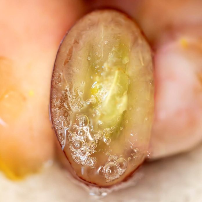 Hetal Vasavada’s Fizzy Fruit