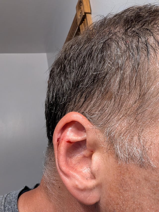 Almost assassinated while mowing my lawn