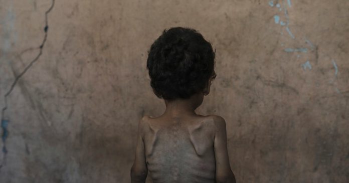 ‘Worst-Case Scenario Of Famine’ Is Happening In Gaza, Food Crisis Experts Warn