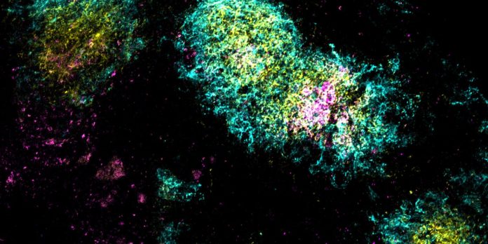 One-shot vaccines for HIV and covid