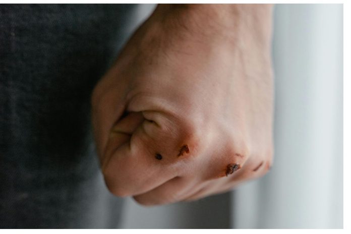 KZN man arrested over alleged assault after social media buzz