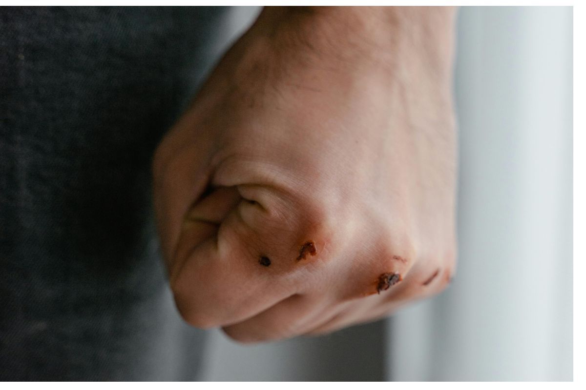 kzn-man-arrested-over-alleged-assault-after-social-media-buzz.jpg KZN man arrested over alleged assault after social media buzz